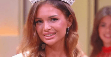 В сеть слили снимки "Мисс Россия" до пластических операций (фото)