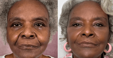 Сын сделал матери несколько пластических операций: за это она заплатила невероятную "цену"