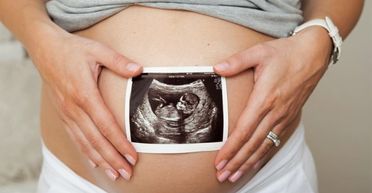 Вагітна не повірила своїм очам, коли вперше побачила кадри з УЗД (фото)