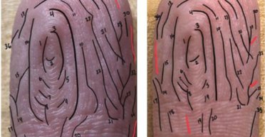 Розкрито ще одну таємницю організму: вчені з'ясували, чому пальці морщаться у воді