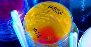 Найден новый антибиотик, способный лечить опасные инфекции: все время скрывался на виду