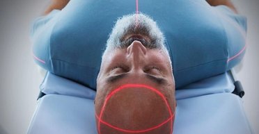 Небезпечне захворювання мозку: боротися з хворобою Альцгеймера можна за допомогою їжі, — учені