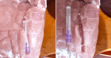 ДОТ не выполнил задачу по преодолению коррупции и обеспечению ВСУ качественной едой, — политолог