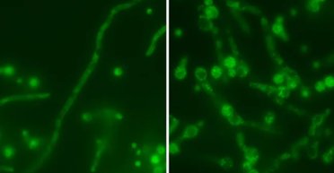 Вирус "русской матрешки" нашли внутри смертельно опасного грибка: он нацелен на людей