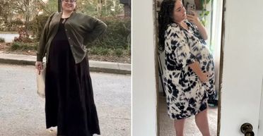 Не вагітна: жінка покоління Z скаржилась на об'ємні форми, але це була не зайва вага (фото)