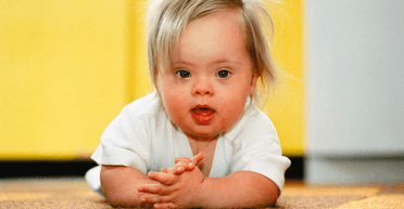 Прорив у лікуванні синдрому Дауна: вчені змогли видалити зайву 21-шу хромосому