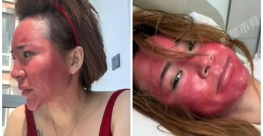 Жінка не змивала макіяж понад 20 років: що сталося з її обличчям зрештою (фото)