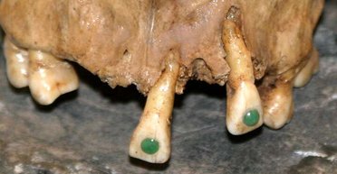 Улыбка на миллион. Древние майя боролись с кариесом при помощи драгоценных камней (фото)