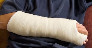 Отсрочка от призыва из-за сломанной руки: адвокат рассказал, можно ли ее получить