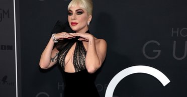 Ринопластика, кантопластика і філери: пластичний хірург "оцінив" обличчя Леді Гаги (відео)