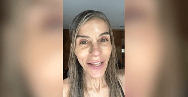 59-річна жінка після десятиліть відмовилася від ботоксу, а потім показала своє обличчя (фото)