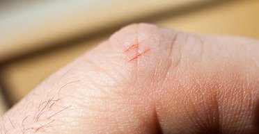 Справжні тортури: вчені розповіли, чому порізи від аркушів паперу так сильно болять