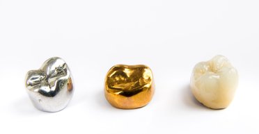 Ученые рассказали, что происходит с золотыми коронками во время кремации