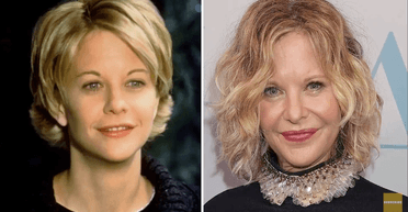 Мег Райан — 64: что случилось с лицом иконы кино 80-х после пластических операций (фото)