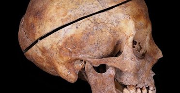 Семейная традиция Комонов: ученые обнаружили следы бальзамирования на телах французских аристократов