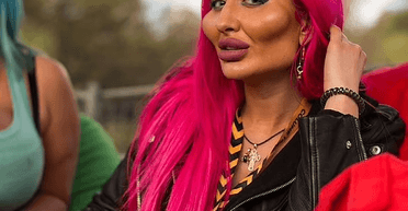 Женщина с самыми большими скулами в мире показала себя без макияжа (фото)