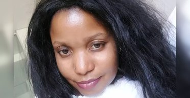 Призначили стажиста: після лазерної епіляції обличчя жінки перетворилося на "шахову дошку"