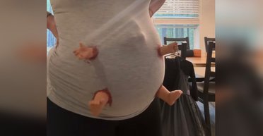 Женщина в "кровавом" костюме на Хэллоуин поехала на вечеринку, а попала в больницу (фото)