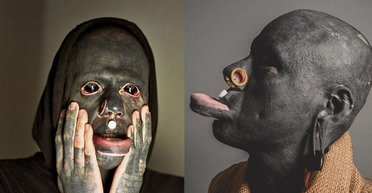 Любитель тату, потратив 100 тысяч фунтов на покрытие тела чернилами, может остаться без кожи