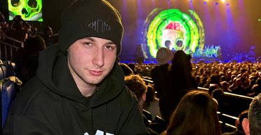 Лысеющий юноша решился пересадить волосы: "побочка" изменила его до неузнаваемости (фото)