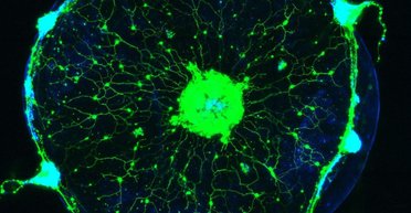 Ученые научились читать мысли медуз, поместив их нервную систему под микроскоп (фото)