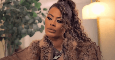 Жінка витратила 6 млн грн на пластичні операції: один імплант випав посеред білого дня