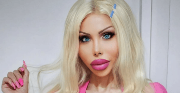 "Барбі в реальному житті": модель витрачає купу грошей на екстремальні операції (фото)