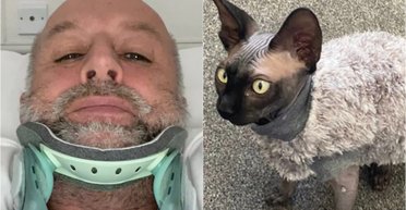 "Пощастило вижити": спіткнувшись об кота, чоловік отримав травми, як в автокатастрофі (фото)