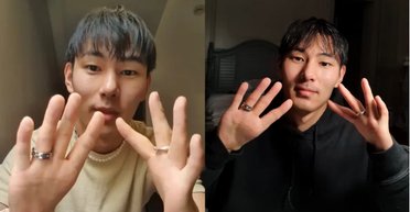 Чоловік народився без великих пальців на руках, люди дивуються, що він може робити без них