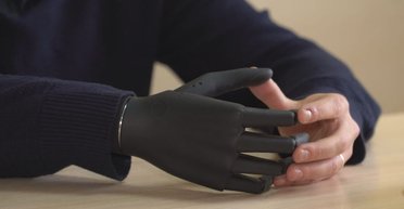 "Не всем нужны бионические руки": во Львове будут протезировать украинцев со сложными ранениями