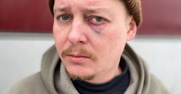 "Вот это съездили на гастроли": в Днепре директор театра избил актера из Чернигова