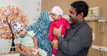 Операція тривала 14 годин: лікарі роз'єднали сіамських близнюків "з однією головою" (фото)