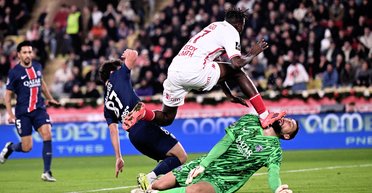 Наклали 10 швів: зірка "ПСЖ" ледь не позбувся ока під час матчу (фото)