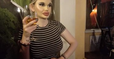 Почему-то убегают: женщина с самыми большими в мире губами жалуется, что не может найти любовь (фото)