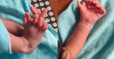 Реінкарнація богині: в Індії народилася дівчинка з 26 пальцями на руках і ногах (відео)