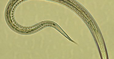 Перше випробування на людях: кишкові черв'яки-паразити успішно запобігають діабету 2 типу (фото)
