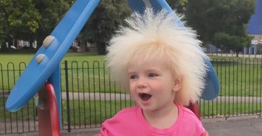 Всего 100 человек в мире: трехлетняя девочка покорила соцсети своей прической (фото, видео)