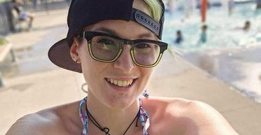 Мать двоих детей с редким "заболеванием вампира" может умереть, если съест чеснок (фото)