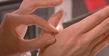 Надмірна турбота: мати імплантувала доньці мікрочип, про який вона не знала довгий час