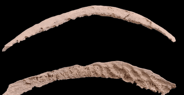 Кто принес сифилис в Европу: ученые наконец-то нашли виновника