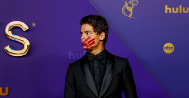 Канадський актор з'явився на премії Еммі з кривавим відбитком долоні на обличчі (відео)