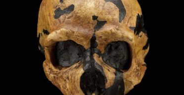 Виноваты наши предки: ученые нашли причину редкого заболевания мозга (фото)