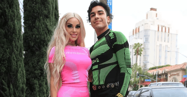 Акт турботи і зцілення: "жива Барбі" хоче омолодитися за допомогою крові свого сина (фото)