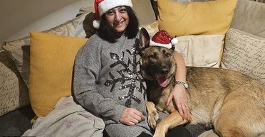 Женщине ампутировали все конечности после того, как ее "облизала собака": сепсис едва не стоил жизни