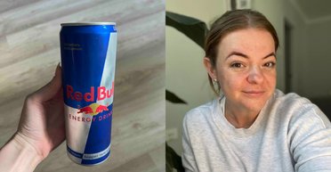 Жінка, яка пила енергетики щодня протягом 15 років, розповіла про наслідки