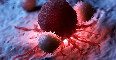 Задушити ракові клітини: вчені знайшли оригінальний спосіб боротьби з пухлинами