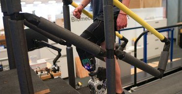 Прорив у протезуванні: біонічні ноги напряму під'єднали до нервової системи та мозку (відео)