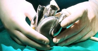 Як у Залізної людини: як працює перше у світі титанове серце (відео)