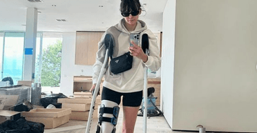 У гіпсі та на милицях: Ніна Добрев поділилася новими знімками після аварії на велосипеді (фото)