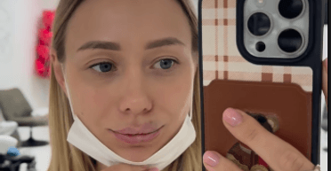 Дружина Віктора Павліка зменшила губи (фото)